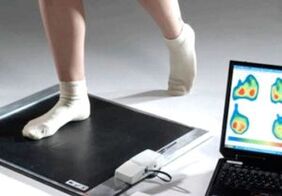 Diagnose van hallux valgus