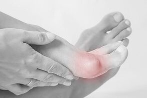Hallux valgus hoe schoenen kiezen