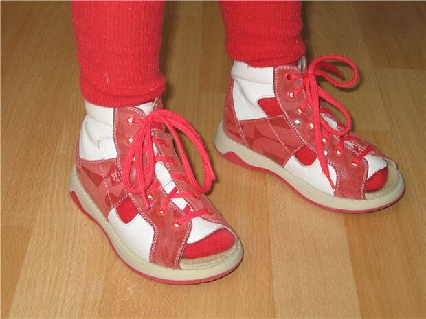 schoenen voor kinderen met hallux valgus