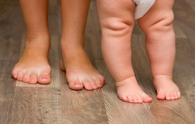 Valgus -vervorming van de voet bij kinderen